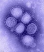 Imagen del virus de la Gripe A/H1N1