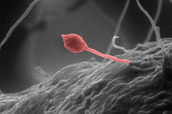 Imagen al microscopio del hongo Gliocladium roseum (UNIVERSIDAD DE MONTANA/Gary Strobel)