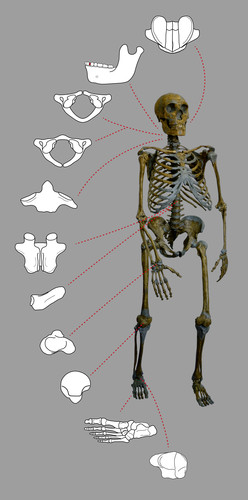 Esqueleto de un neandertal con 11 de las anomalías físicas encontradas en el estudio. Imagen: CSIC.