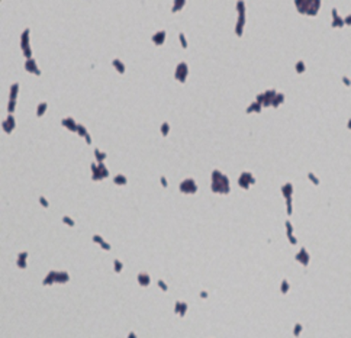 Dermabacter hominis, tinción de Gram. FOTO: Isabel Fernández Natal.