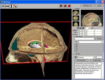 Visor anatómico del cerebro. Imagen: Juan A. Juanes.