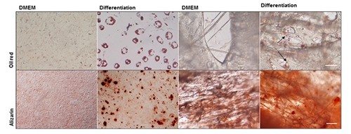 En pruebas con ratones, un biomaterial mantuvo vivas a las células mesenquimales y redujo el tamaño de una lesión isquémica/Zamproni et al. 2019