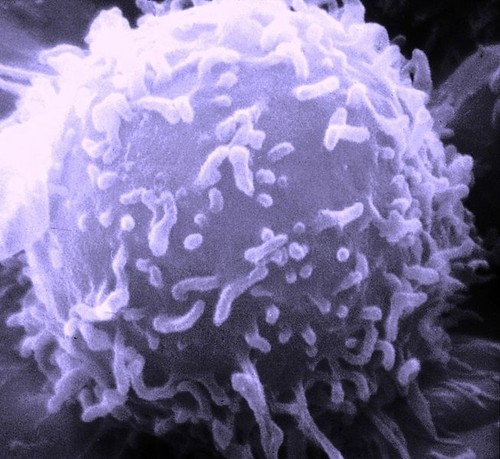 El gas que produce el organismo favorece la diferenciación de linfocitos del subtipo Th9, que generan una citocina capaz de agravar la respuesta inflamatoria (imagen linfocito: Wikimedia)