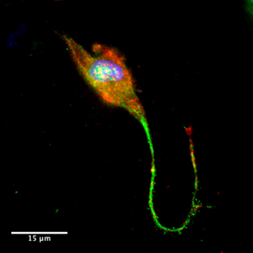Neurona generada a partir de células de la piel. Imagen: UPO.