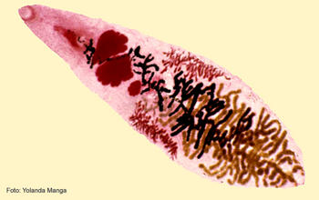 Imagen de un hígado de oveja con huevos del microorganismo 'Dicrocoelium dendriticum'.