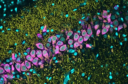 Cuerpos celulares de neuronas de CA2 marcados en magenta con sus ramificaciones dendríticas en amarillo. En azul se marcan todos los núcleos celulares./ Elena Cid.