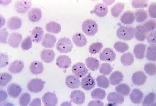 Malaria. Imagen: CSIC.