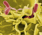Imagen al microscopio electrónico de 'Salmonella typhimurium' infectando células humanas