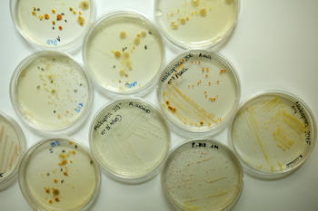 Placas de Petri con cultivos de microorganismos recogidos durante la expedición Malaspina. Foto: CSIC.