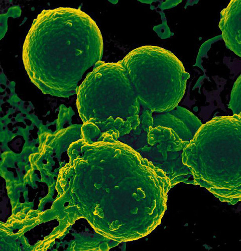 El grupo de Bioquímica y Biología Molecular de las Micobacterias trabaja con compuestos naturales que el organismo utiliza para combatir las bacterias. FOTO: UN