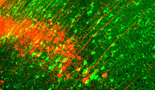 Neuronas modificadas: En verde neuronas de roedor modificadas. Fotografía de Mako Yamamoto.