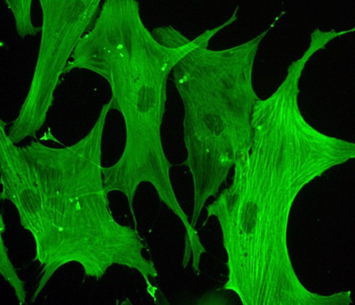 Células de válvulas aórticas humanas con sus microfilamentos tintados vistas al microscopio/CSIC-IBGM