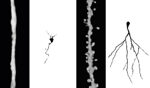 En los ratones viejos sedentarios las dendritas de las neuronas se desarrollaron menos que en los ratones corredores/Conicet