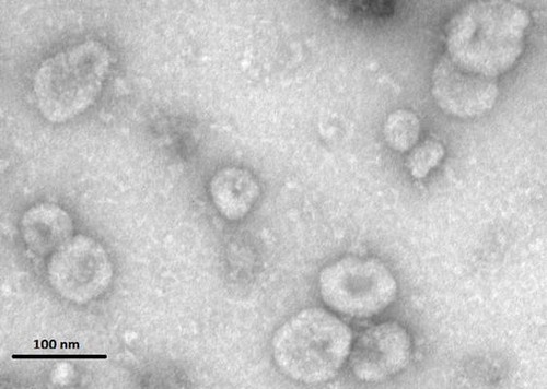 Vesículas extracelulares liberadas de células de melanoma metastásico./Carmen Campos, Cristina Patiño y Mar Valés.
