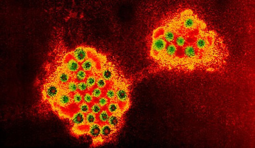 Partículas basadas en anticuerpos de llama podrían servir para combatir al norovirus, la causa viral más importante de gastroenteritis en humanos de todas las edades.  Créditos: Science Photo Library.