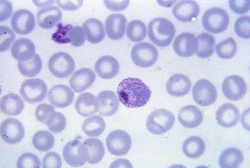 Paludismo/imagen: CDC/ Steven Glenn