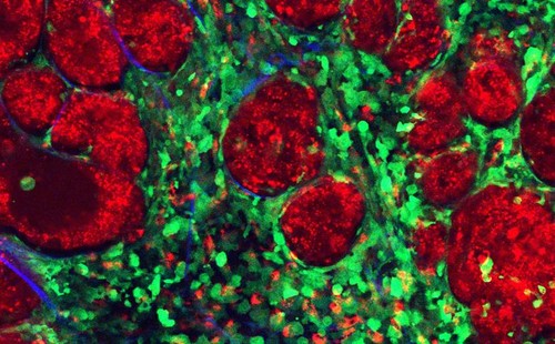 En rojo, células cancerígenas; en verde, células normales; en azul, fibras de colágeno de la matriz extracelular./IBBTEC.