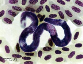 Hemoparásitos observados al microscopio.