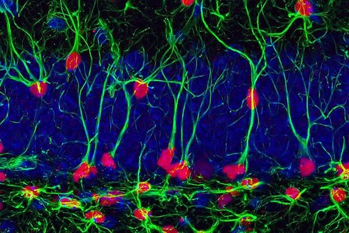 Tinción de células madre neurales que expresan SOX2 (rojo) y GFAP (verde) en la capa de células granulares dentadas de un hipocampo de ratón macho adulto. Autor: Patricia Tezanos, Kerry R. McGreevy, José L. Trejo