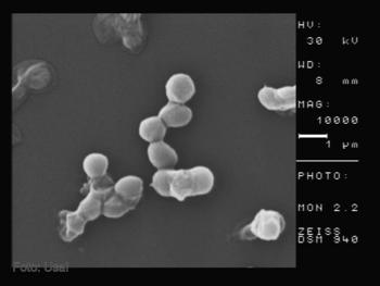Fotografía microscópica de la nueva especie de microorganismos encontrada.
