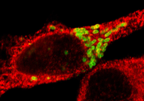 Imagen microscópica de la bacteria de la brucelosis (color verde) reproduciéndose en el interior de un glóbulo blanco de ratón (color rojo). El estudio liderado en el Instituto Leloir sienta bases para el desarrollo futuro de terapias eficaces/R. Siei