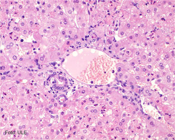 Hígado infectado con el virus de la enfermedad hemorrágica del conejo