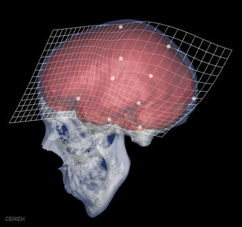 Otra imagen del cerebro con la que ha trabajado Bruner
