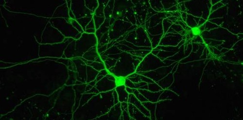 Dos neuronas. Foto: Instituto de Neurociencias.