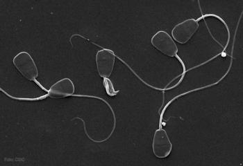  Espermatozoides de gacela Mohor observados con microscopía electrónica de barrido.