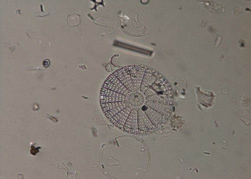 Diatomácea Arachnodiscus spp. dos sedimentos do Pacifico. FOTO: UP.
