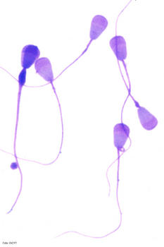 Espermatozoides de gacela Mohor teñidos y observados con microscopía óptica.