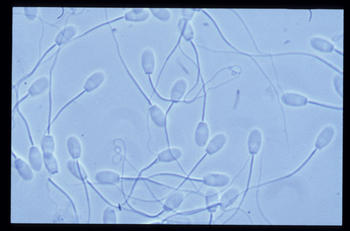 Una muestra al microscopio de espermatozoides.
