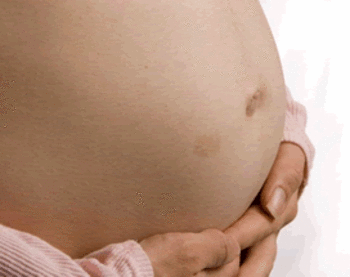 Muchos partos o un parto mal asistido pueden desencadenar la incontinencia (FOTO: Aupec).