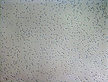 'Bacillus sp.', bacteria aislada de las superficiesmetálicas corroídas. Foto: INBIOTEC.