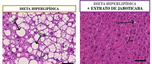 Fotomicrografías de hígados de ratones que muestran la merma de la acumulación de lípidos y la preservación de la morfología de los órganos tras el tratamiento con extracto de cáscara de guapurú.