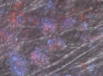 Tal y como muestra esta imagen detallada, la quitridiomicosis es una enfermedad que afecta las células de la piel de los anfibios. (Foto: Doug Woodhams/STRI)