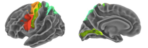 Los autores del estudio identificaron el rol de las regiones del cerebro asociadas con la planificación del movimiento empleando resonancia magnética a 15 voluntarios.
