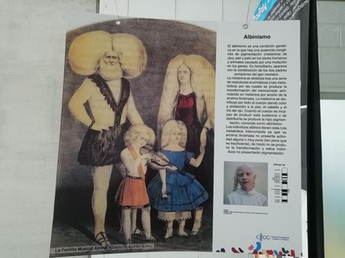 Albinismo en el arte. Foto: Priscila Imbaquingo.