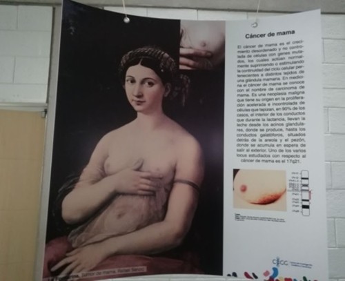 Un ejemplo sobre cáncer de mama en la exposición. Foto: Priscila Imbaquingo.