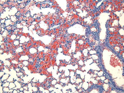 Corte histológico de pulmón de ratón inyectado por vía intravenosa con 25 microgramos de la toxina hemorrágica BlatH1. Imagen: A. Rucavado.