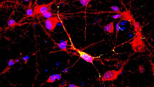 Cultivo de neuronas humanas diferenciadas que expresan sinucleina en rojo y mitocondrias en verde. Azul corresponde a núcleos celulares. Foto: gentileza Tomás Falzone.