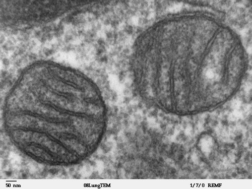 La restricción calórica favorece el funcionamiento celular Estudios científicos con animales muestran que la intervención dietética hace que las mitocondrias –los orgánulos que producen energía en las células– trabajen mejor (imagen: Wikimedia
