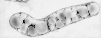 Bacteria del género Rhodococcus.