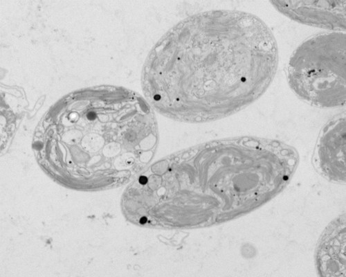 Imagen de microscopía electrónica de transmisión de células de Chlamydomonas sp. ChlSP mostrando acumulaciones de uranio en su interior como gránulos densos a los electrones (puntos negros). Imagen: IRNASA.