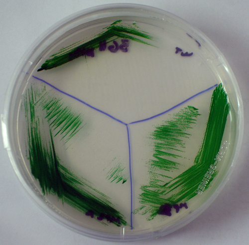 Biomasa de Synechococcus en medio sólido. Foto: UA.