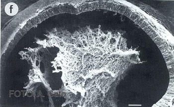 Imagen del cerebro fluido cerebroespinal.