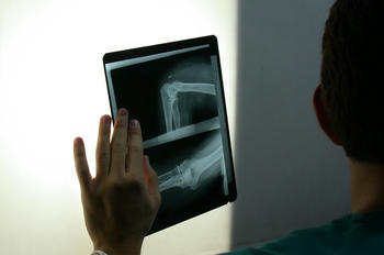 Doctor observando la radiografía de una articulación (Foto:MEC)