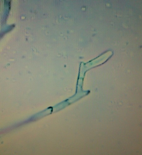 El hongo patógeno 'Fusarium circinatum' al microscopio/Crédito Diana Bezos
