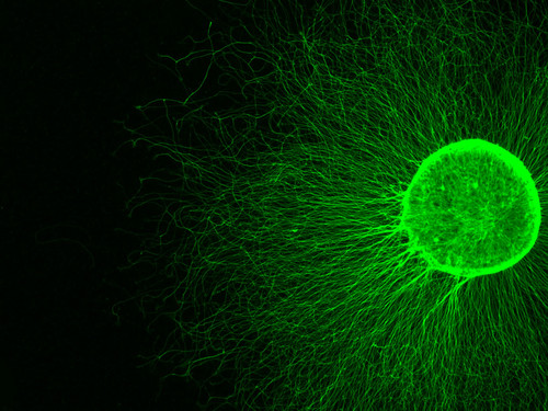 Microscopia de fluorescencia de axones de neuronas sensoriales en cultivo/Gentileza investigadores Conicet