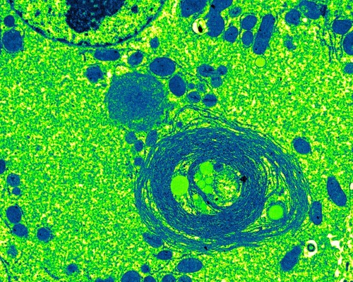 Autofagia deficiente de células hepáticas. Imagen: CIBER.